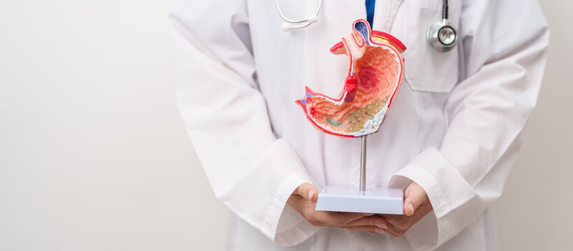 Doctor with Gastric anatomy model. Gastroenterologist consultation, stomach diseases and ulcers, November stomach cancer, Gastroesophageal Reflux Disease, GERD, Acid reflux and healthcare medical