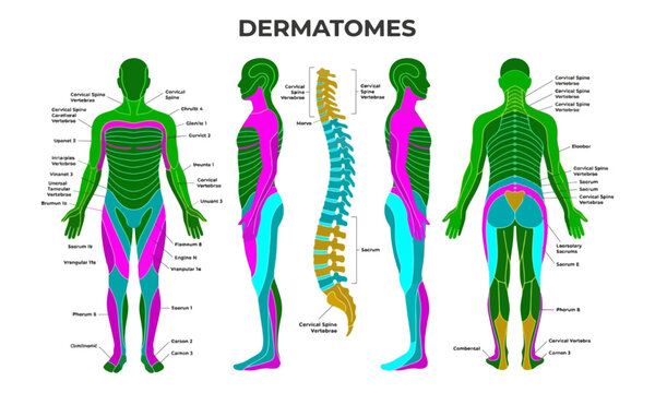 Human Dermatome Map showing Spinal Nerve Skin Segments