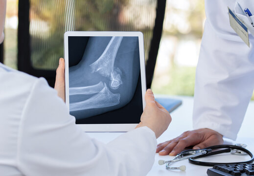 Radiology and medicine concept. doctor explaining the results of scan arm on digital tablet screen to patient