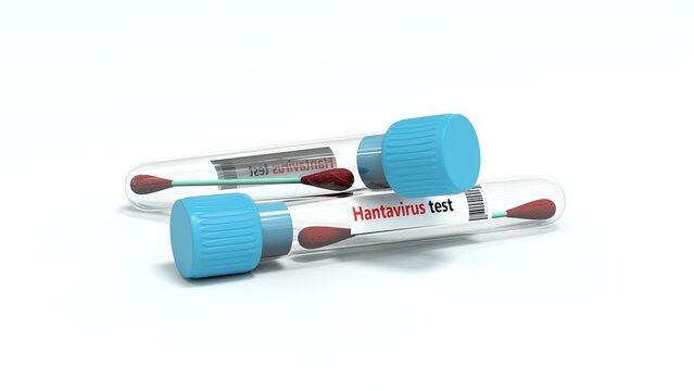 Hantavirus Test Swab Samples in Lab Test Tubes on White Background - 3D rendering