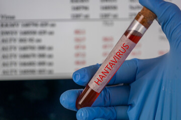 Naklejka premium hantavirus test tube blood sample hand blue glove cruise ship background sea water medical diagnostics infection control laboratory analysis with copy space, medicine, epidemiology