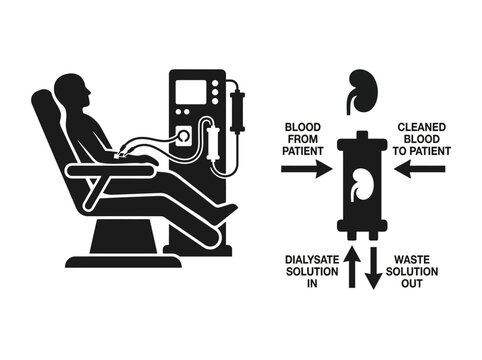 Hemodialysis machine diagram black silhouette illustration with labeled components