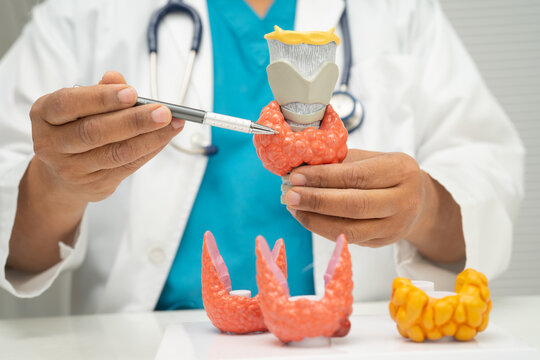 Hyperthyroidism, Overactive Thyroid, Thyroid Lymphoma, Asian doctor with thyroid gland human anatomy model in hospital.