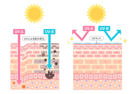 UV-AとUV-Bによる肌ダメージとUVカット効果の比較を肌断面図で表したイラスト