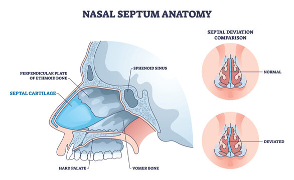 Nasal septum anatomy illustrated, side view shows septal cartilage, vomer bone, and ethmoid plate with normal vs deviated comparison for airflow clarity. Outline diagram