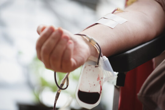 Blood donor hand detail during blood donation procedure