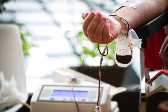 Blood donor hand detail during blood donation procedure