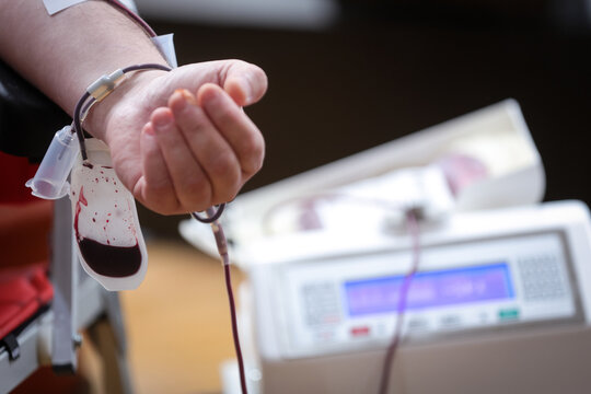 Blood donor hand detail during blood donation procedure