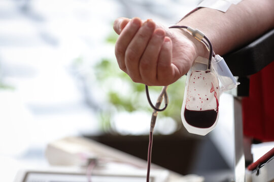 Blood donor hand detail during blood donation procedure