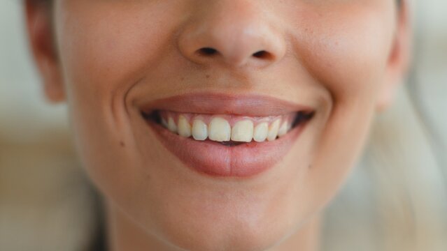 Close up female mouth smiling showing healthy white teeth dental oral care Indian Arabian woman unrecognizable girl whitening clinic medicine health toothy smile lady beauty detail indoors apartment