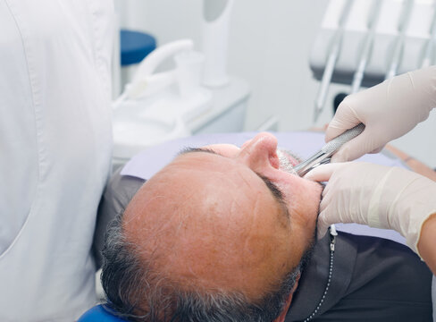 Dentist performing a tooth extraction on an older man at a bright dental clinic, focusing on oral surgery and health care