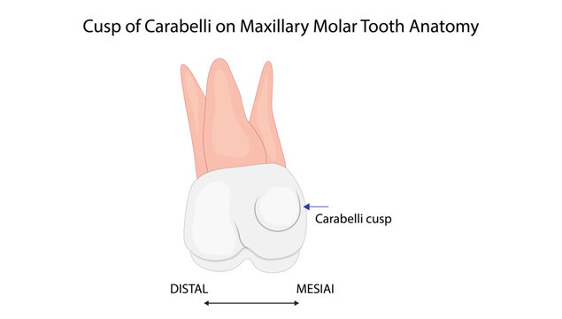 Cusp of Carabelli on Maxillary Molar Tooth Anatomy
cusp of Carabelli on the mesial aspect of a maxillary molar tooth.