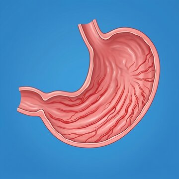 GAVE (Watermelon Stomach): A detailed internal view of the stomach's antrum showing distinct, radiating red streaks of dilated blood vessels resembling the stripes on a watermelon, symbolizing Gastric