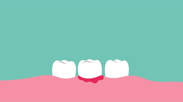 Loose Tooth Wiggle Dental Pain Medical Animation Illustration