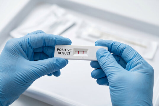 Gloved hands holding rapid antigen test showing positive disease result