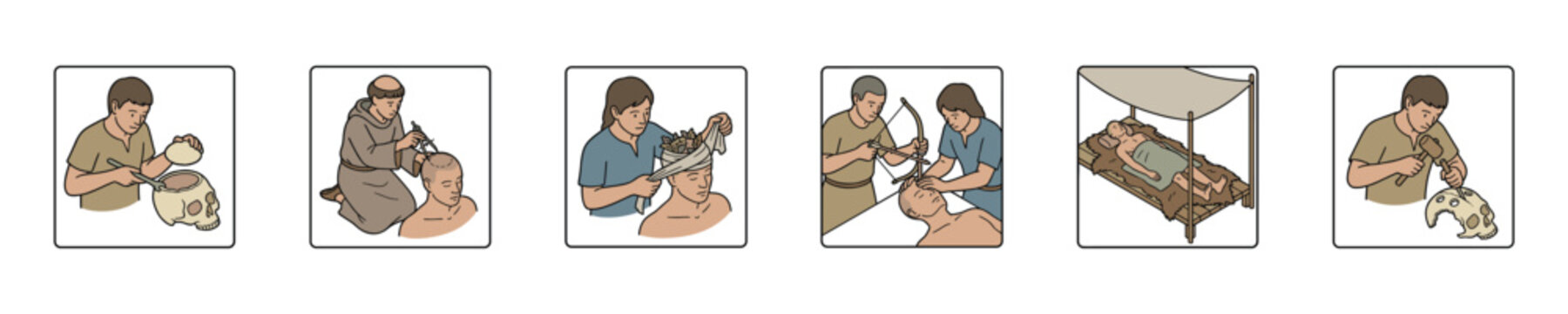 Ancient medical practices depicted through historical illustrations of healing and surgery