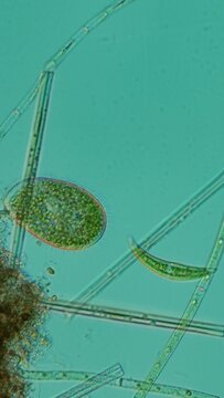 Paramecium bursaria and Closterium Under Polarized Microscopy