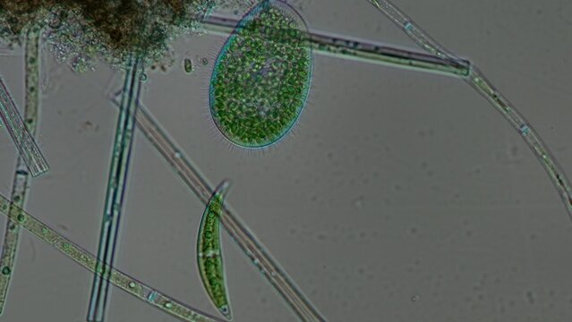 Paramecium bursaria and Closterium Under Polarized Microscopy