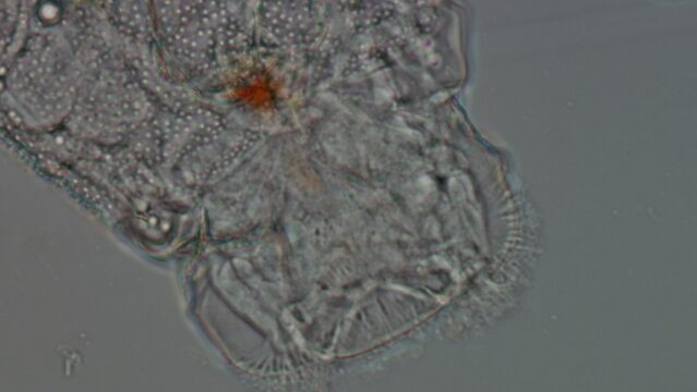 Eosphora najas Rotifer Detail Under Brightfield Microscopy