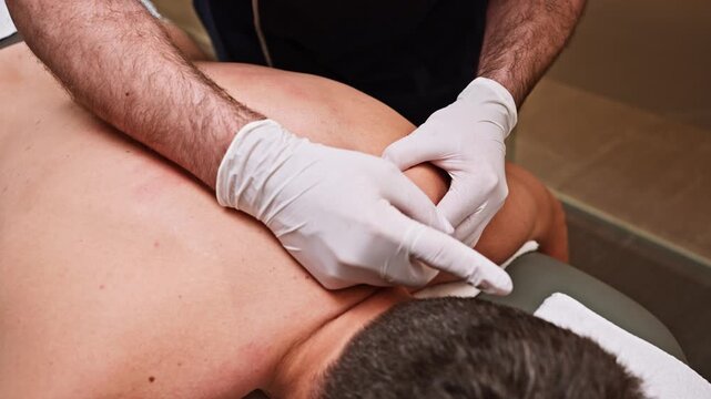 Physiotherapist performing dry needling on a patient's shoulder