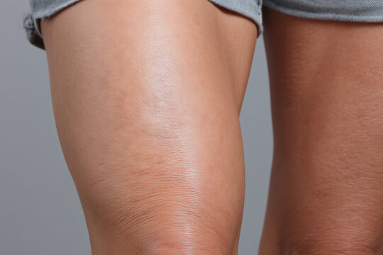 Close up lower thigh skin smooth gentle marks slight cellulite natural texture healthy skin tone