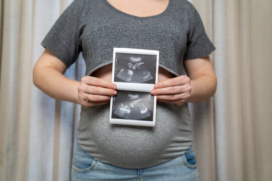 Pregnant woman holding ultrasound scan photos near baby bump at home. Prenatal care, maternity healthcare, pregnancy monitoring and expecting mother concept with sonogram images.