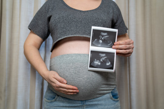 Pregnant woman holding ultrasound scan photos near baby bump at home. Prenatal care, maternity healthcare, pregnancy monitoring and expecting mother concept with sonogram images.
