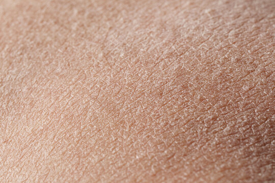 Man with dry skin on black background, closeup