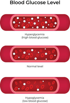 Blood Glucose Level Design Vector Illustration