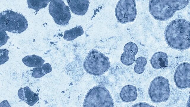 4K Ultra HD footage of Hantavirus high-risk viral respiratory alert with dangerous airborne pathogens infecting lung cells.