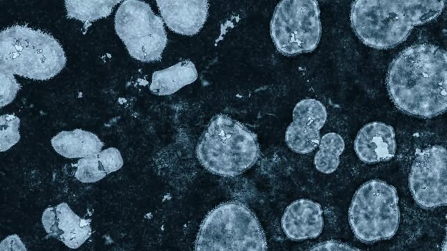4K Ultra HD footage of a Hantavirus high-risk viral respiratory alert tracking a critical pulmonary syndrome outbreak and global biohazard infection threat.