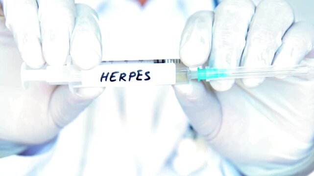 4K Ultra HD footage of a Herpes vaccine development concept featuring a medical scientist working on HSV immunization research and viral cure breakthrough.