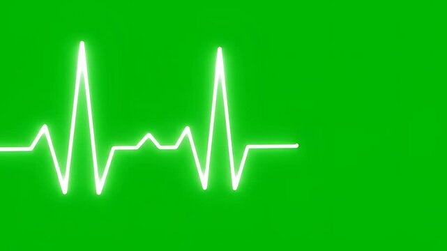 Green screen electrocardiogram heart rate monitor pulse line.