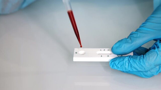 Close up of laboratory worker applying blood sample to rapid diagnostic test during medical analysis and disease screening in laboratory.