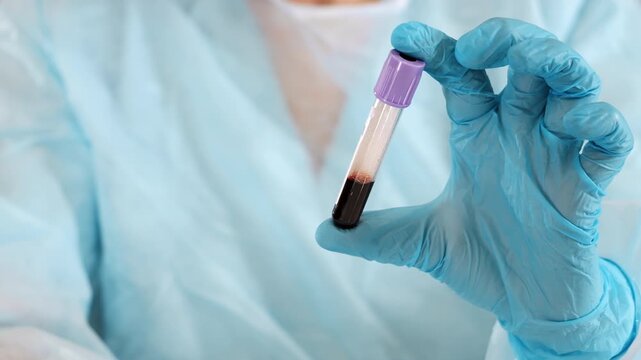 Close up of laboratory technician in protective gloves holding blood sample tube for clinical testing and medical diagnostics in laboratory.
