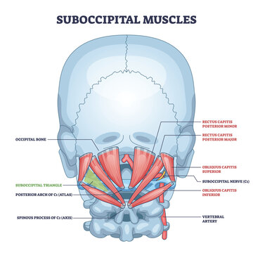 Suboccipital muscles diagram showing deep neck stabilizers, highlights rectus capitis, obliquus capitis, and suboccipital triangle for head posture and motion. Outline diagram