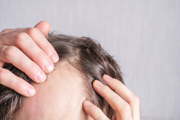 Fototapeta premium Man touching her hair close-up on gray background, hair loss concept.