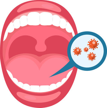 Mouth Infection Illustration