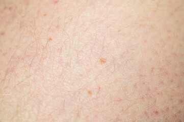 Fototapeta premium Close-up macro view of human skin texture with fine hairs and small blemishes