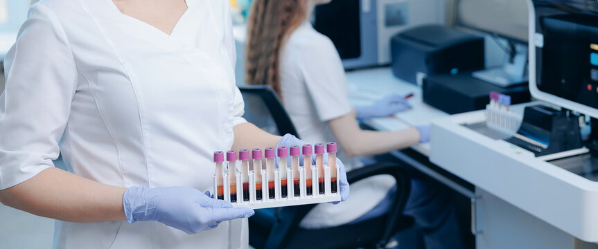 Medical laboratory technician presenting rack of blood sample tubes for clinical diagnostics and testing with analyzer in lab