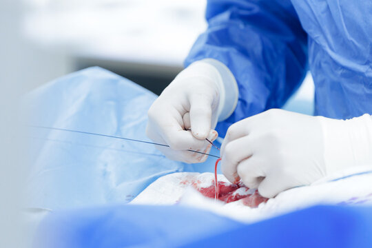 Closeup of gloved hands manipulating catheter and guidewire during cardiac catheterization procedure for interventional cardiology