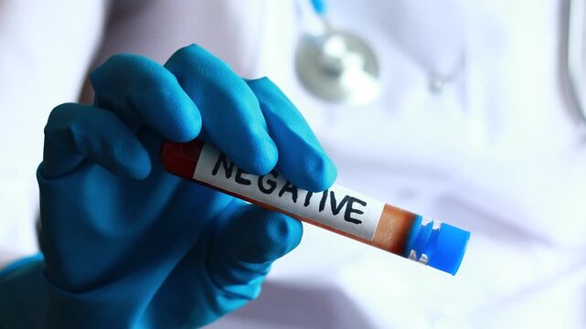 Medical professional holds test tube showing negative result for disease in laboratory setting during daytime.
