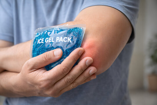 Ice gel pack on painful elbow, elbow pain relief therapy, cold compress treatment for sports injury. Arm inflammation swelling recovery, muscle strain, joint pain, tendon injury, healthcare rehabilita