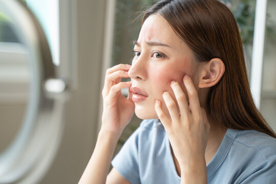 Sensitive skin with cosmetology, Asian young woman looking at red spot on her face from cosmetic allergy in the mirror.