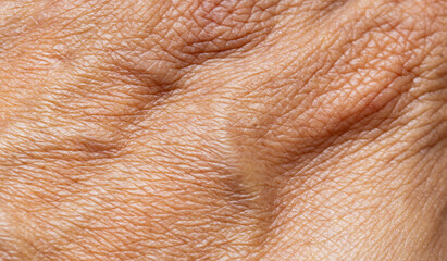 Naklejka premium Extreme close-up macro of human skin texture showing aging lines and wrinkles,Macro,A detailed macro shot of human skin, highlighting the natural texture, pores, and intricate patterns of wrinkles,