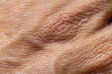 Fototapeta premium Extreme close-up macro of human skin texture showing aging lines and wrinkles,Macro,A detailed macro shot of human skin, highlighting the natural texture, pores, and intricate patterns of wrinkles,