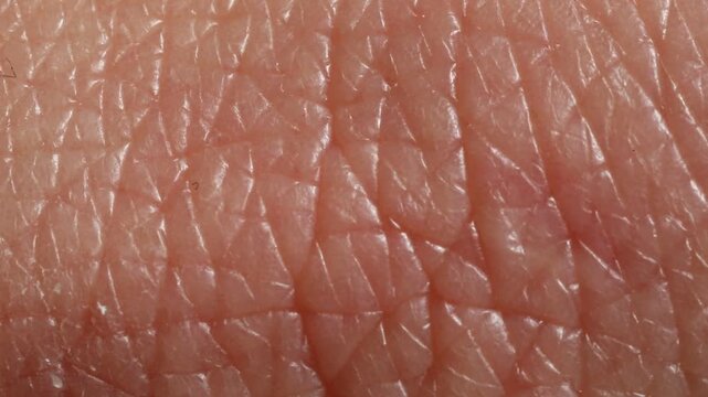 Texture of normal skin as background, closeup