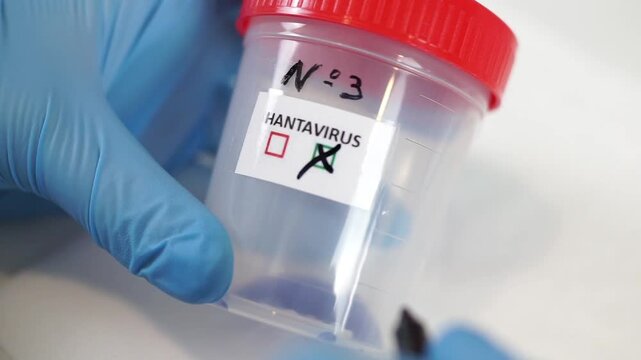Close-up of a researcher wearing blue nitrile gloves using a black marker to check the "negative" box on a Hantavirus specimen container.