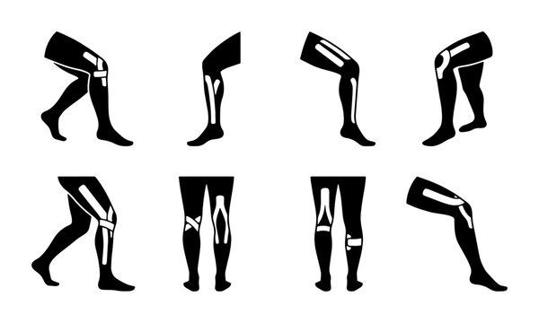 Anatomical Knee Joint Icons, Human Leg Anatomy Vector Set, Medical Science Illustration, Orthopedic Health Diagrams