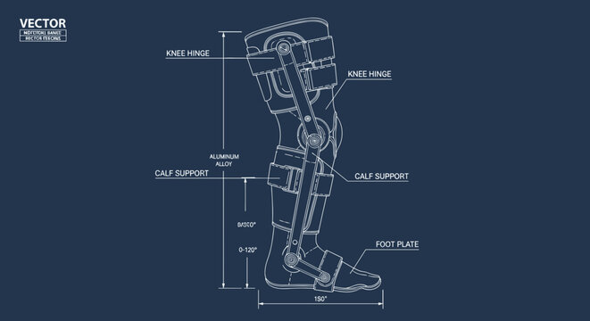 Detailed orthopedic leg brace blueprint illustration on dark blue background showcasing components and measurements